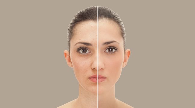 Doctora Elizabeth Palafox medicina estetica con Bioestimuladores y Botulínica